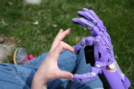 3d printed prosthetic from enabling the future 